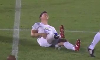 Un joueur simule une crampe à la jambe alors qu'il a une prothèse !